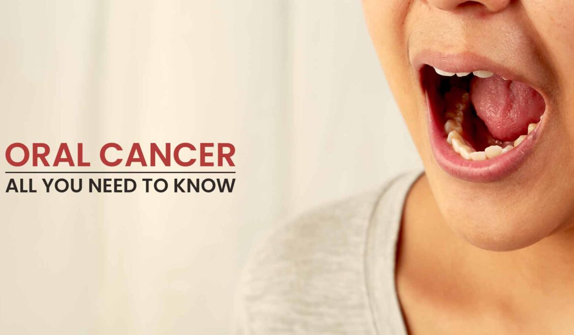 Dr. Sanjog Oral Cancer specialist in Nagpur